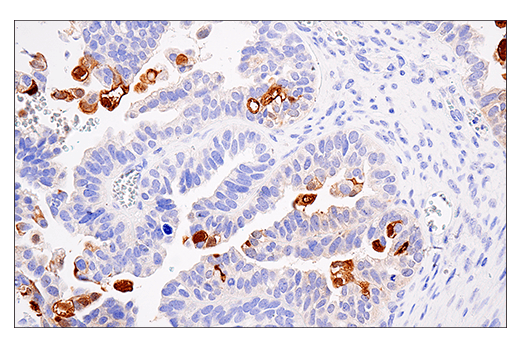 Immunohistochemistry Image 1: S100A7 (E7X2C) Rabbit Monoclonal Antibody