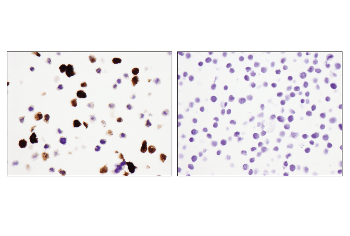 Immunohistochemistry Image 5: S100A9 (D5O6O) Rabbit Monoclonal Antibody (BSA and Azide Free)