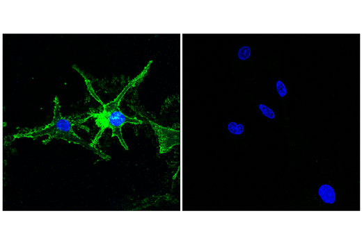 Immunofluorescence Image 1: CD81 (E2K9V) Rabbit Monoclonal Antibody