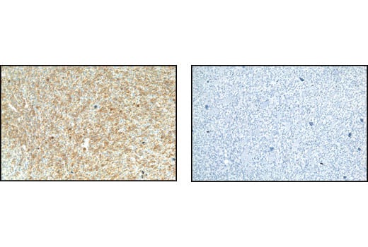 undefined Image 13: Met Signaling Antibody Sampler Kit