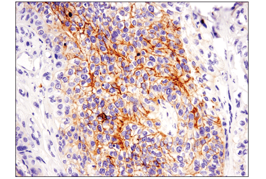 Immunohistochemistry Image 1: c-Kit (D3W6Y) Rabbit Monoclonal Antibody