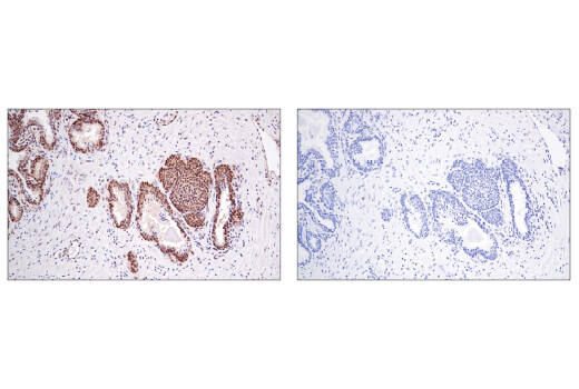 Immunohistochemistry Image 4: MGMT (E9O4V) Rabbit Monoclonal Antibody
