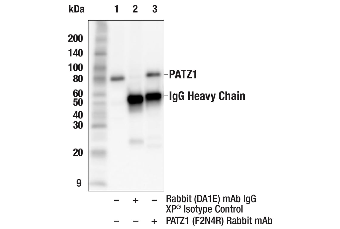 Immunoprecipitation Image 1: PATZ1 (F2N4R) Rabbit Monoclonal Antibody