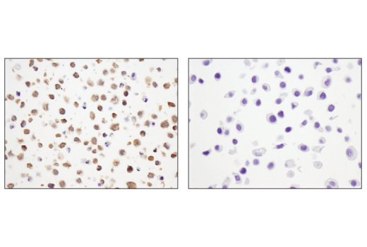 Immunohistochemistry Image 1: STK33 (D3S4R) Rabbit Monoclonal Antibody
