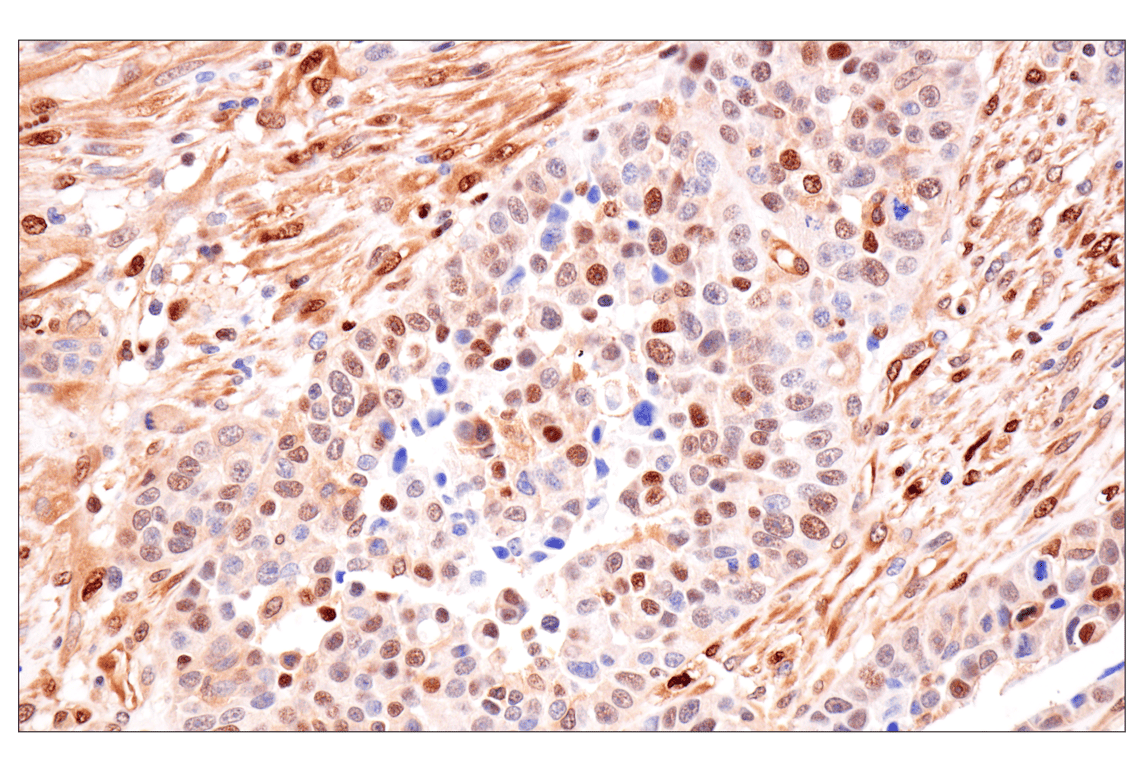 Immunohistochemistry Image 4: Phospho-ATP-Citrate Lyase (Ser455) (F4T8R) Rabbit Monoclonal Antibody