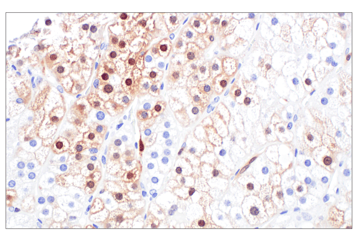 Immunohistochemistry Image 8: p16 INK4A (F9T1L) Rabbit Monoclonal Antibody