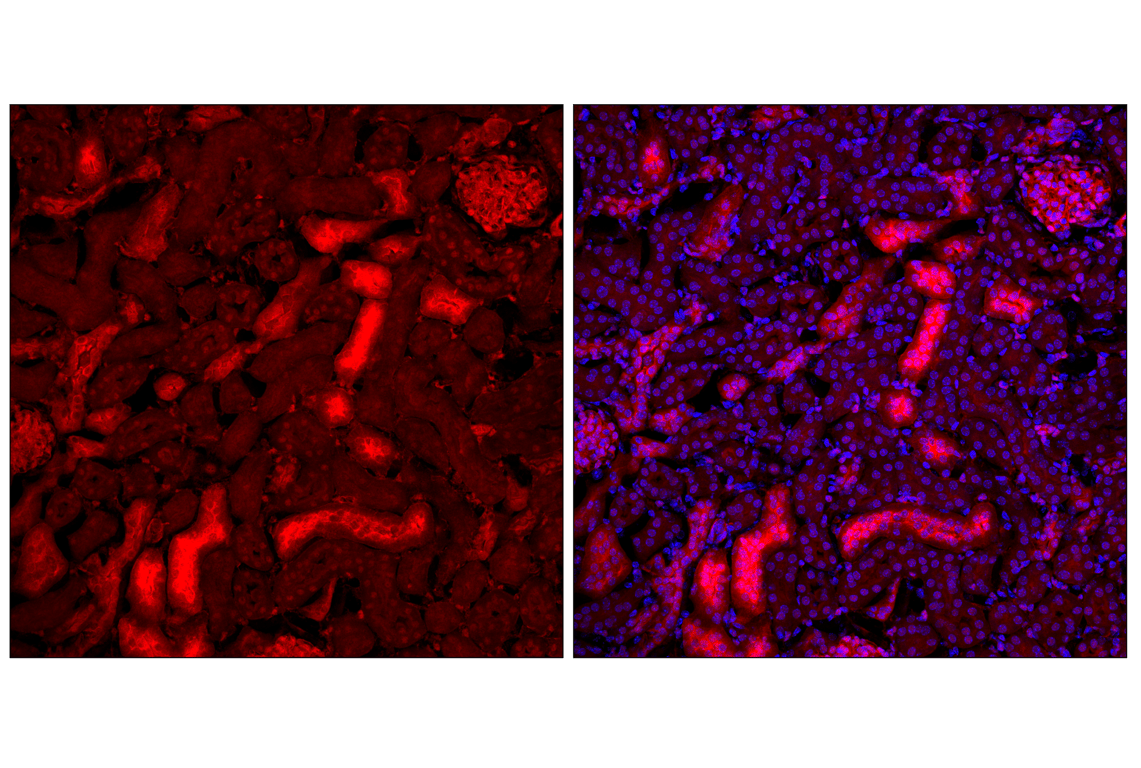 Immunofluorescence Image 2: YAP (D8H1X) Rabbit Monoclonal Antibody (Alexa Fluor<sup>®</sup> 647 Conjugate)