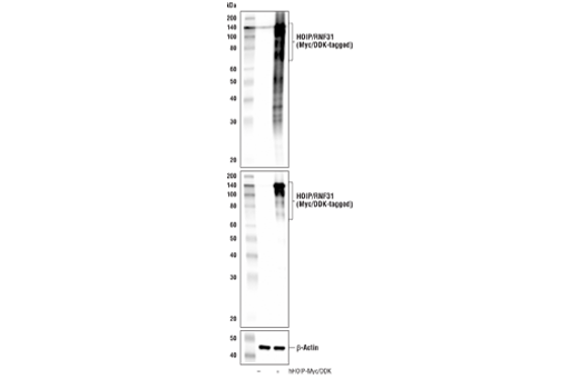 Western Blotting Image 2: HOIP/RNF31 (E6M5B) Rabbit Monoclonal Antibody