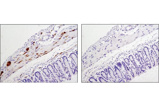 Immunohistochemistry Image 4: Phospho-Tau (Thr181) (D9F4G) Rabbit Monoclonal Antibody