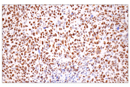 Immunohistochemistry Image 11: CPSF4 (E2L2Z) Rabbit Monoclonal Antibody