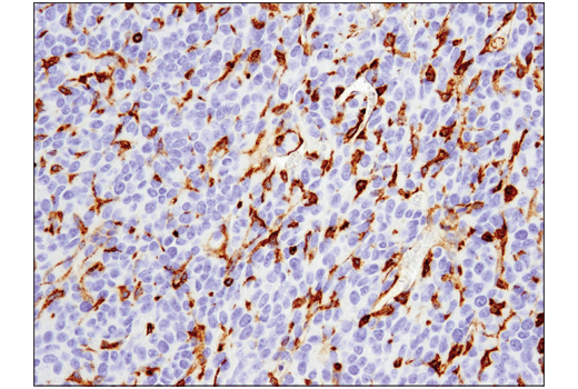 Immunohistochemistry Image 1: VISTA (D5L5T) Rabbit Monoclonal Antibody