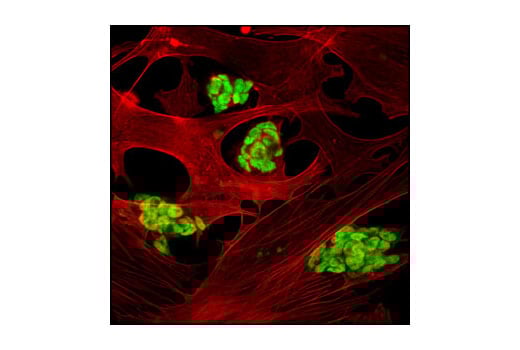Immunofluorescence Image 2: SUZ12 (D39F6) Rabbit Monoclonal Antibody (BSA and Azide Free)