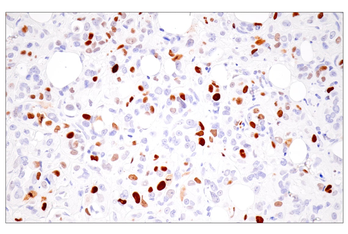 Immunohistochemistry Image 8: UHRF1 (E5W8W) Rabbit Monoclonal Antibody
