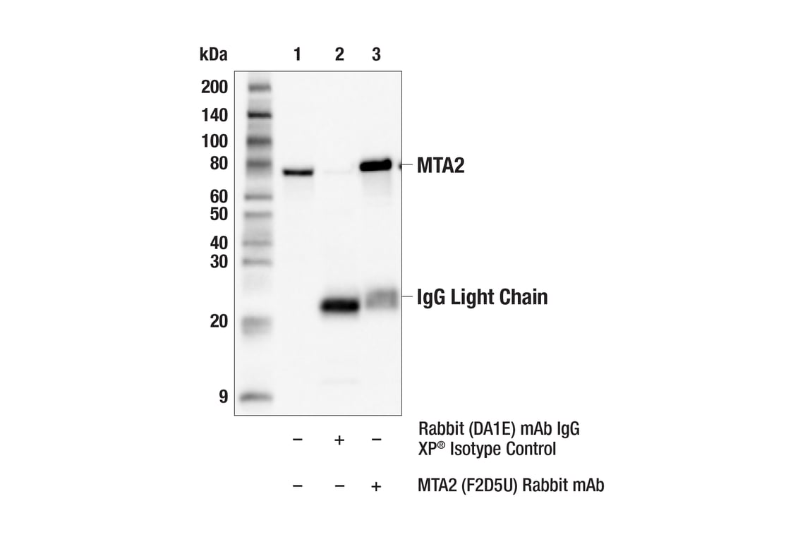 Immunoprecipitation Image 1: MTA2 (F2D5U) Rabbit Monoclonal Antibody