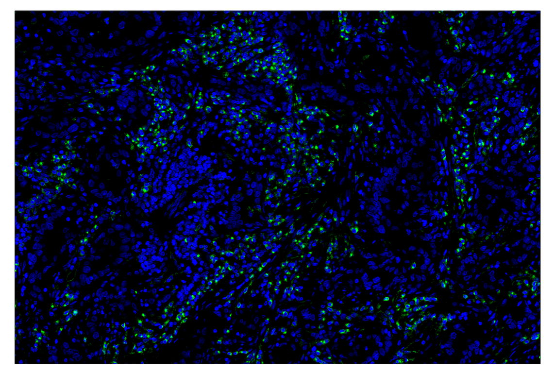 Immunohistochemistry Image 1: VISTA (D1L2G) & CO-0185-647 SignalStar<sup>®</sup> Oligo-Antibody Pair