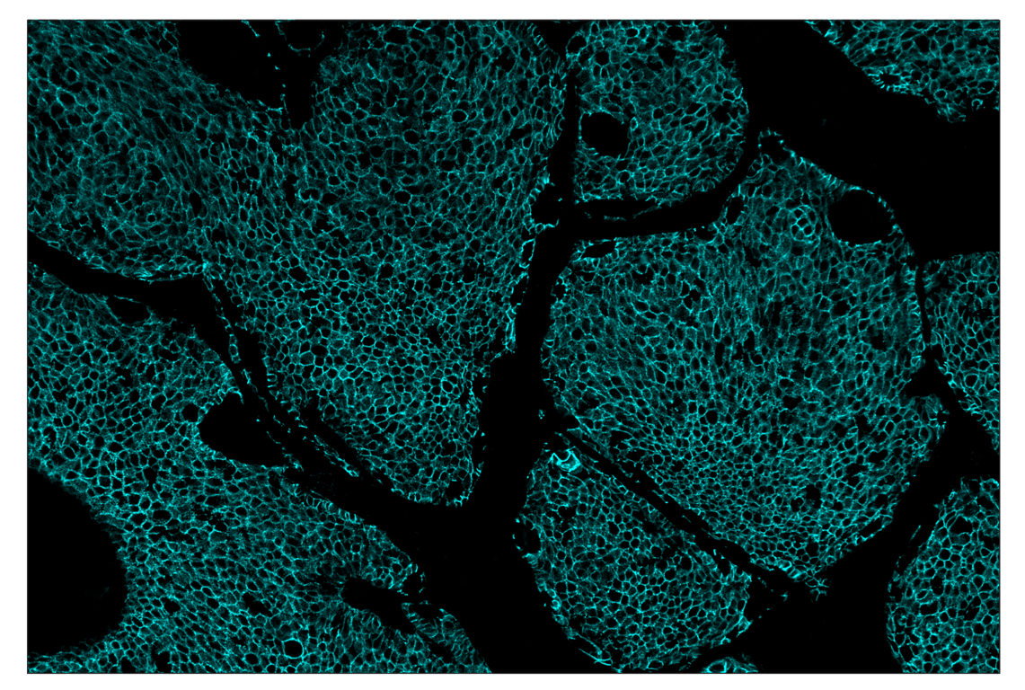 Immunohistochemistry Image 5: E-Cadherin (24E10) & CO-0103-647 SignalStar<sup>™</sup> Oligo-Antibody Pair