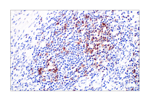 Immunohistochemistry Image 4: TIGIT (E5Y1W) Rabbit Monoclonal Antibody