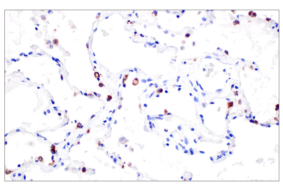 Immunohistochemistry Image 6: NPC1 (E7S4N) Rabbit Monoclonal Antibody