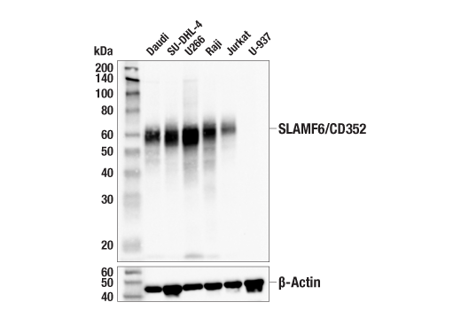 Western Blotting Image 2: SLAMF6/CD352 (E3H1E) Rabbit Monoclonal Antibody (BSA and Azide Free)