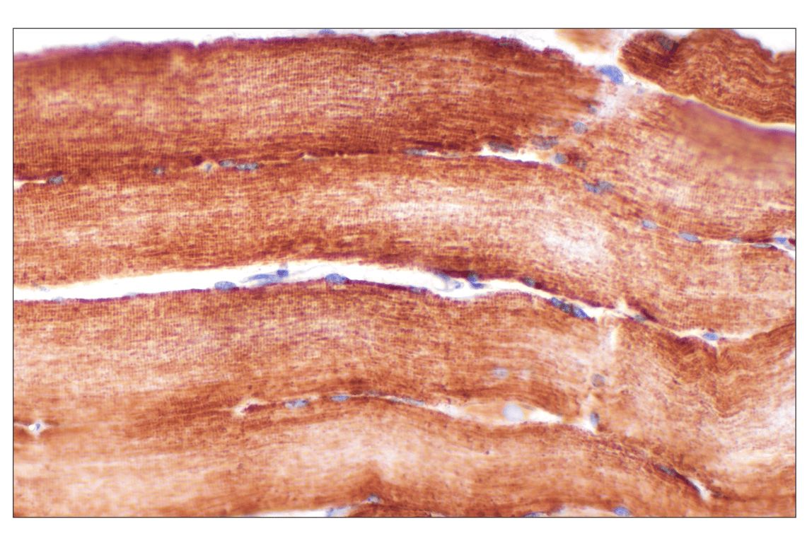 undefined Image 37: Organelle Localization IF Antibody Sampler Kit