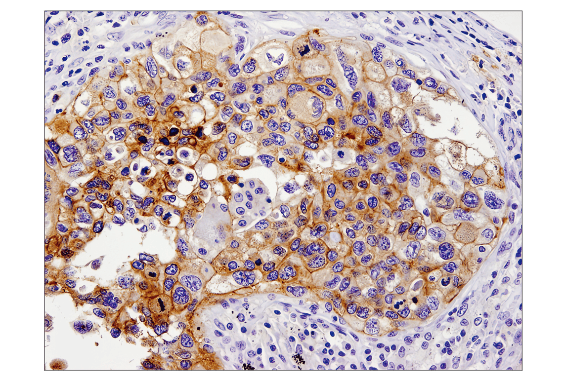 Immunohistochemistry Image 1: PD-L1 (E1L3N) Rabbit Monoclonal Antibody (BSA and Azide Free)
