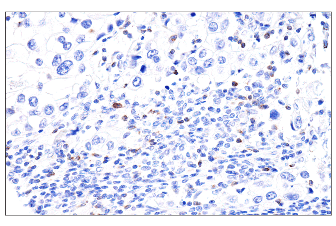 Immunohistochemistry Image 2: Perforin (IHC646) Mouse Monoclonal Antibody