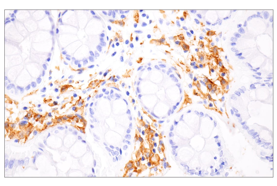 Immunohistochemistry Image 5: HLA-DRA (E9R2Q) Rabbit Monoclonal Antibody (BSA and Azide Free)