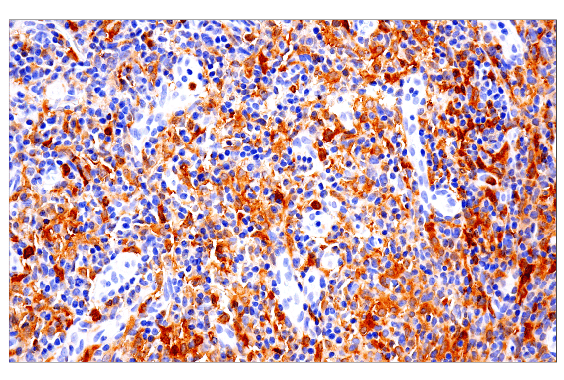 Immunohistochemistry Image 2: IRF-5 (E7F9W) Rabbit Monoclonal Antibody