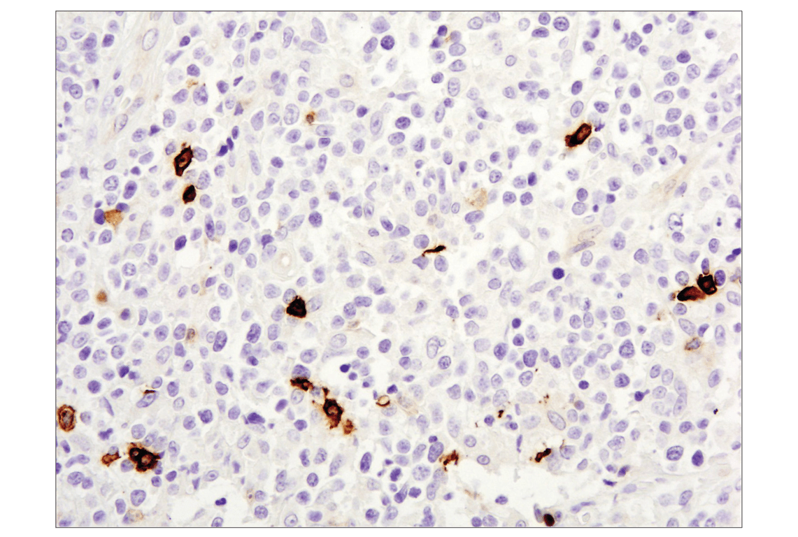 Immunohistochemistry Image 4: OX40 (E9U7O) Rabbit Monoclonal Antibody (BSA and Azide Free)