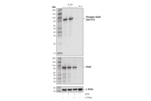 Western Blotting Image 2: Phospho-Stat3 (Ser727) (D8C2Z) Rabbit Monoclonal Antibody (Biotinylated)