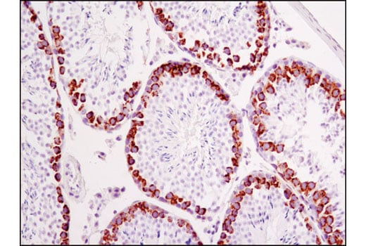 Immunohistochemistry Image 1: Mili (D14F5) Rabbit Monoclonal Antibody