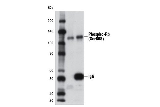 Immunoprecipitation Image 1: Phospho-Rb (Ser608) (D10F2) Rabbit Monoclonal Antibody