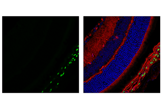 Immunofluorescence Image 1: Sox10 (E2V9N) Rabbit Monoclonal Antibody