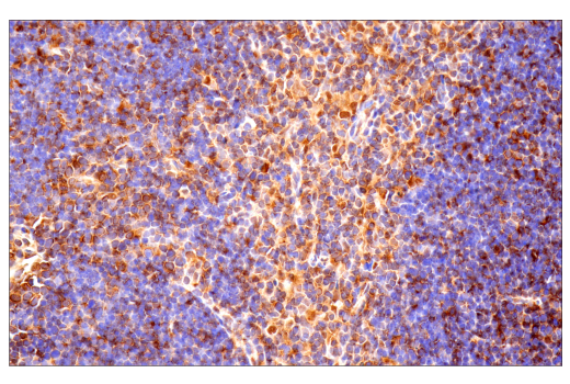 Immunohistochemistry Image 11: Ubiquitin (E6K4Y) Rabbit Monoclonal Antibody