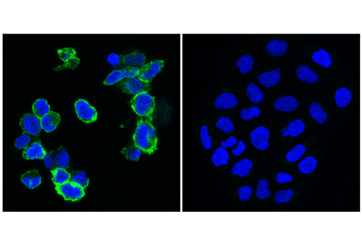 Immunofluorescence Image 1: TIGIT (E5Y1W) Rabbit Monoclonal Antibody (BSA and Azide Free)