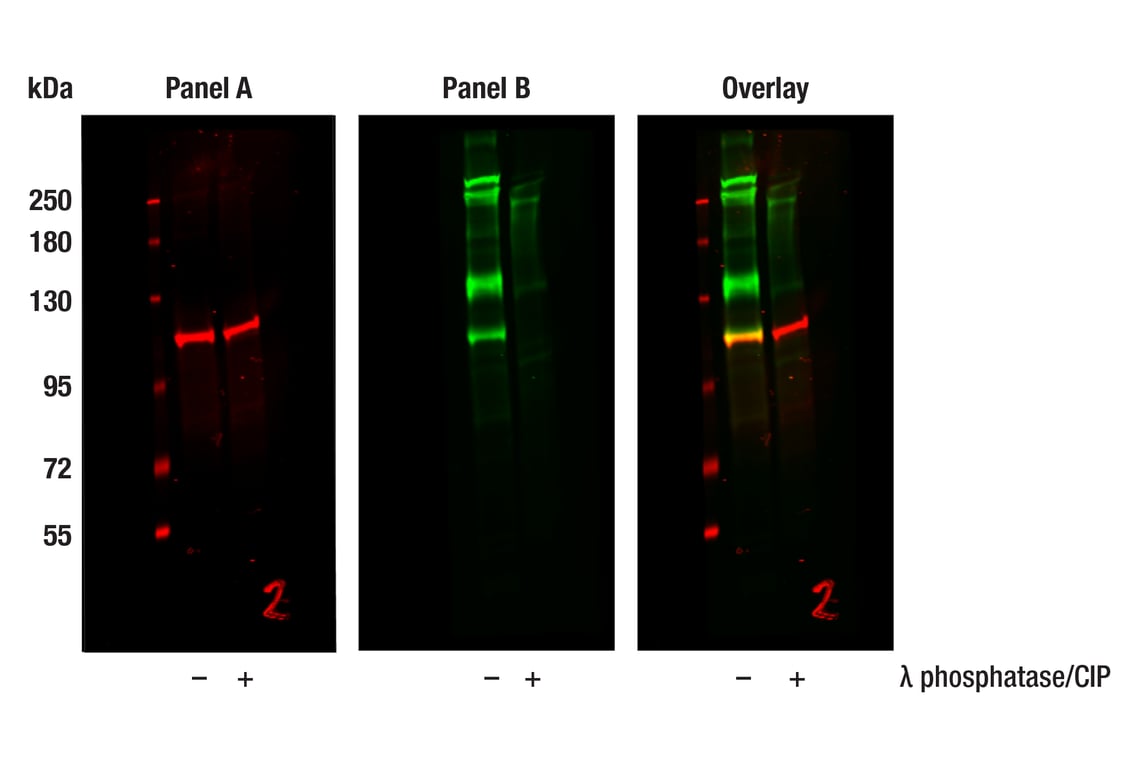 undefined Image 29: Rb Antibody Sampler Kit