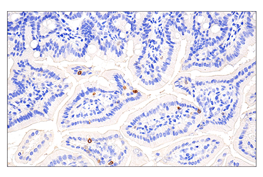 Immunohistochemistry Image 1: 4-1BB/CD137/TNFRSF9 (E2J5H) Rabbit Monoclonal Antibody