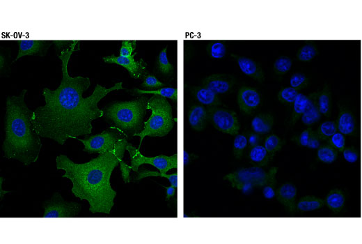 Immunofluorescence Image 1: alpha-E-Catenin (D9R5E) Rabbit Monoclonal Antibody