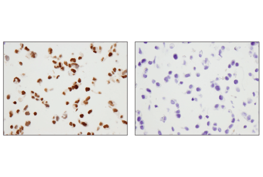 Immunohistochemistry Image 1: Pax6 (D3A9V) Rabbit Monoclonal Antibody
