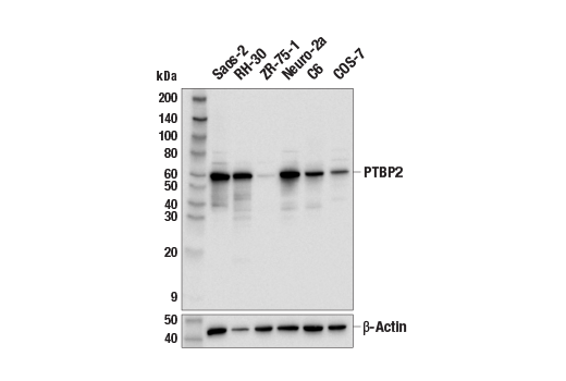 Western Blotting Image 2: PTBP2 (E7C7S) Rabbit Monoclonal Antibody