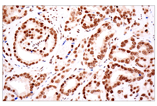 Immunohistochemistry Image 12: TDP43 (E2G6G) Rabbit Monoclonal Antibody
