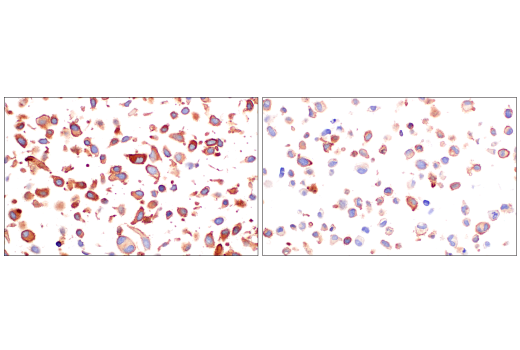 Immunohistochemistry Image 6: CD109 (E4I2V) Rabbit Monoclonal Antibody