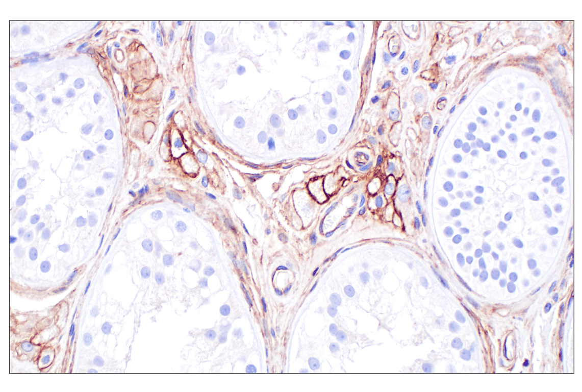 Immunohistochemistry Image 5: CD105/Endoglin (F9C5Q) Rabbit Monoclonal Antibody