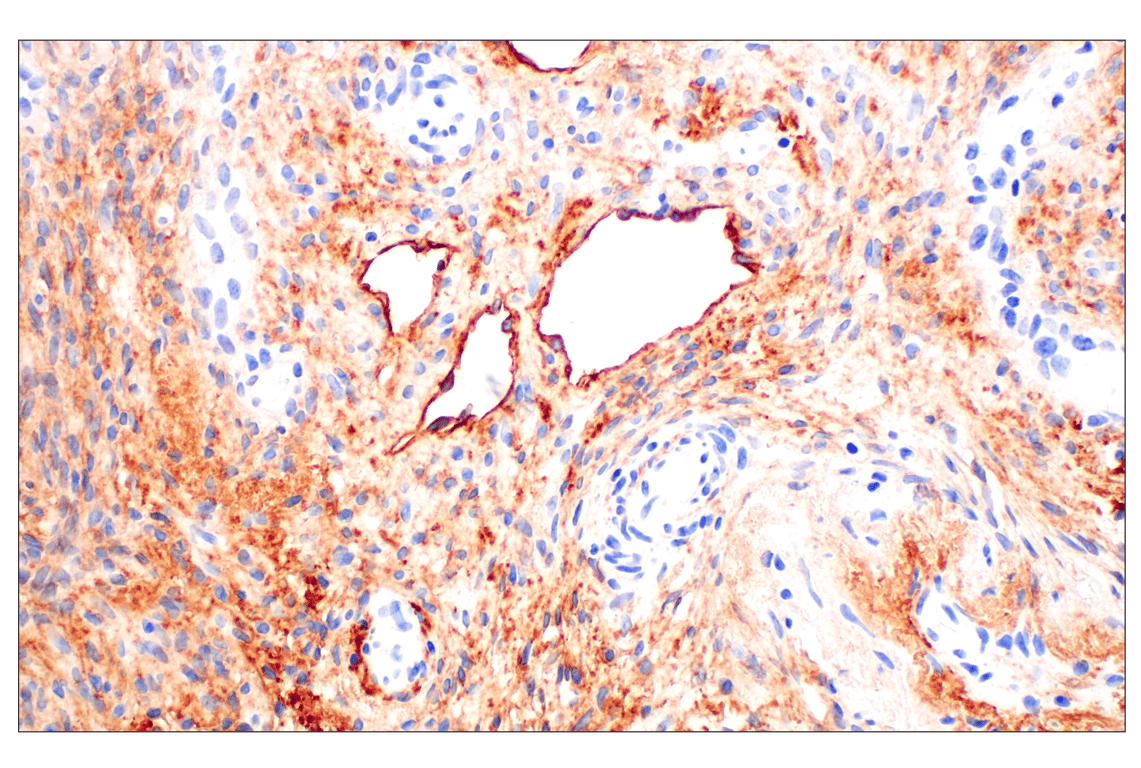Immunohistochemistry Image 8: Neuropilin-2 (E5Q2G) Rabbit Monoclonal Antibody