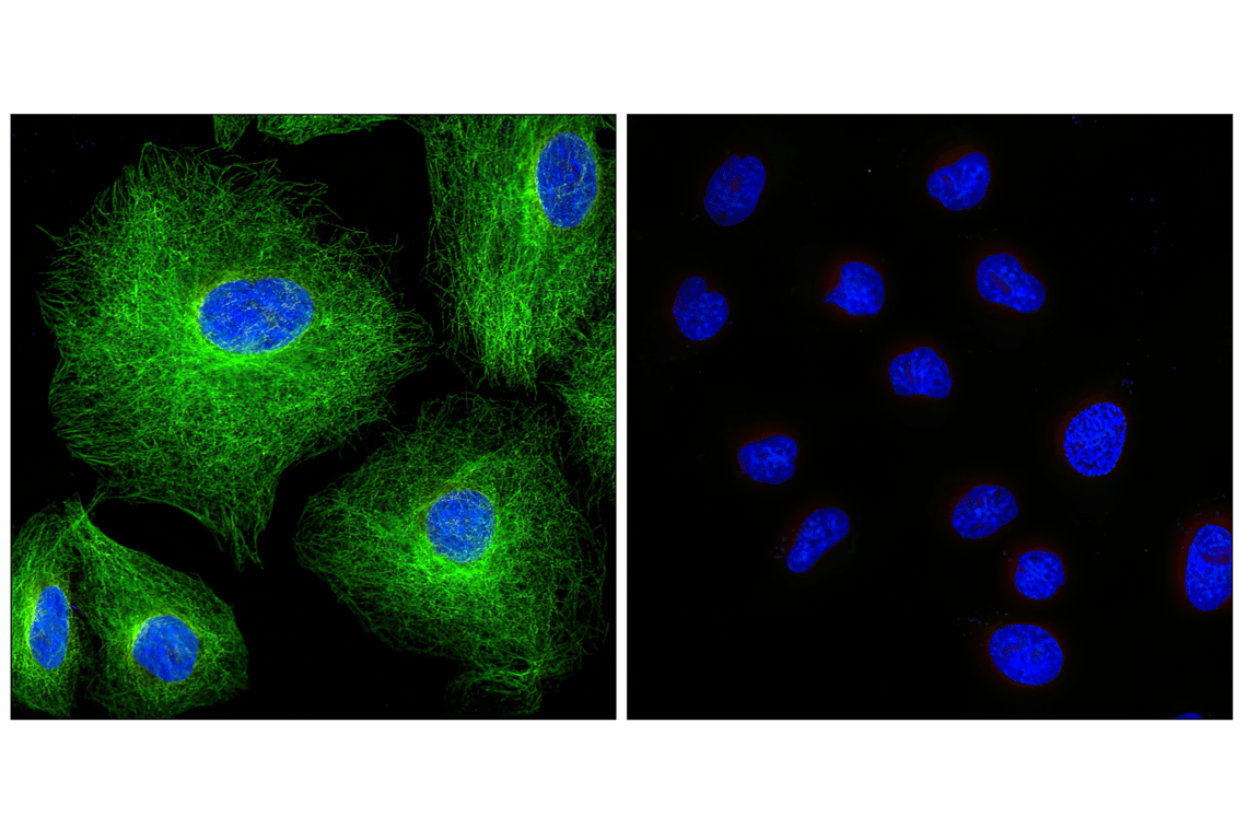 Immunofluorescence Image 1: Rabbit (DA1E) Monoclonal Antibody IgG Isotype Control (BSA and Azide Free)