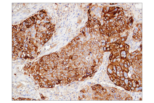 Immunohistochemistry Image 1: CD47 (D3O7P) Rabbit Monoclonal Antibody (BSA and Azide Free)