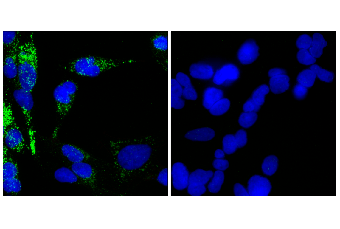 ADAM12 (F9J1B) Rabbit Monoclonal Antibody | Cell Signaling Technology