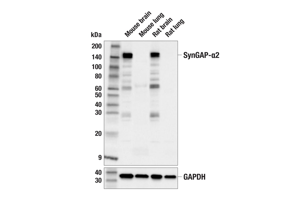 Western Blotting Image 3: SynGAP-alpha2 (E4Y6I) Rabbit Monoclonal Antibody