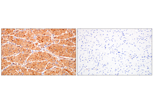Immunohistochemistry Image 9: HSP20 (E6O7A) Rabbit Monoclonal Antibody