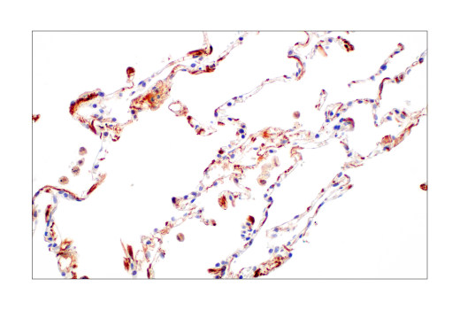 Immunohistochemistry Image 4: ApoE4 (E5M4L) Rabbit Monoclonal Antibody